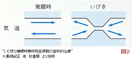 (図2)