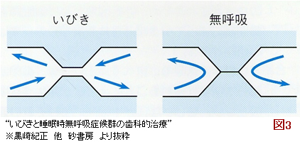 (図3)